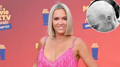 Teddi Mellencamp Promo Has Staples Removed After Brain Tumor Surgery