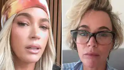 Teddi Mellencamp takes off her wig, showing her real hair amid cancer battle